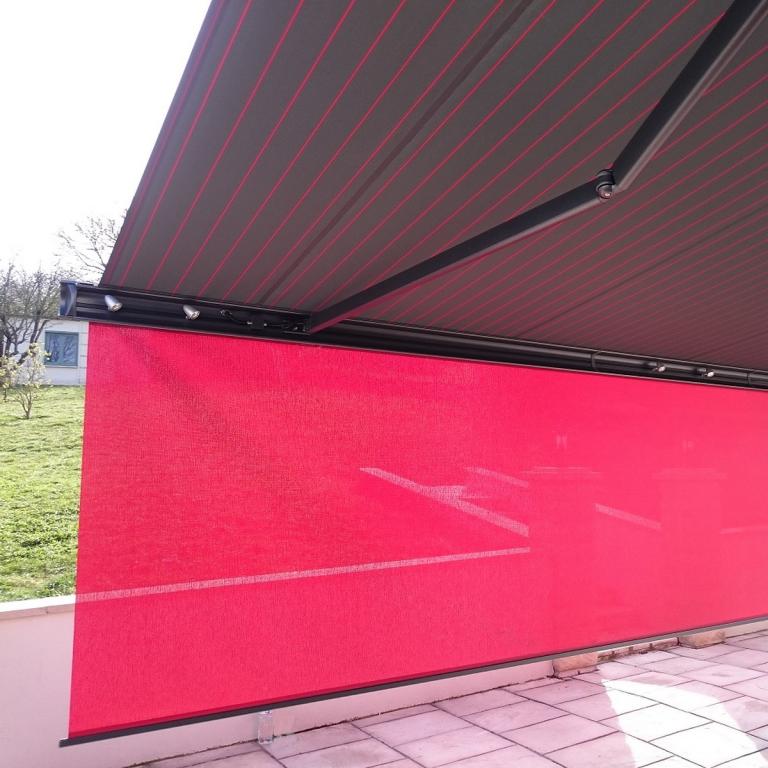 Installation de store banne à Nancy, Pont-à-Mousson, Longwy ou Villerupt : quel type de store banne choisir ?